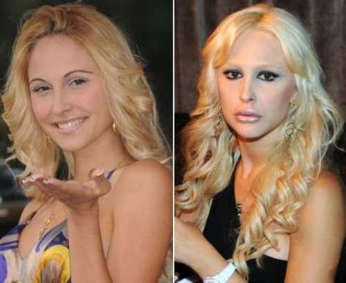 noemi letizia prima e dopo