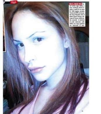 Noemi Letizia labbra gonfiate