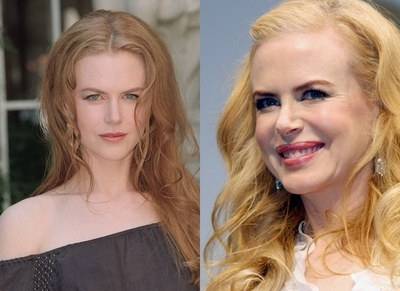Nicole Kidman prima e dopo