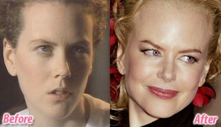 Nicole Kidman cambiamenti