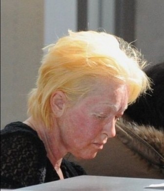 Cindy Lauper col volto irriconoscibile