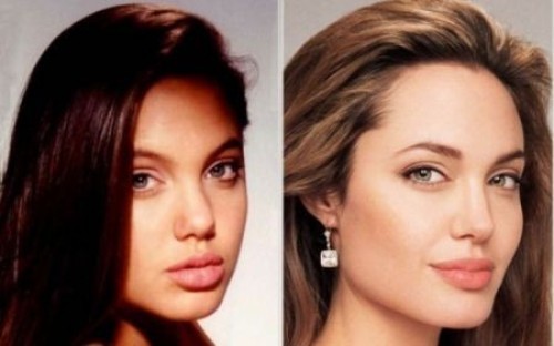 Vip rifatti: le foto delle star che sono ricorse alla chirurgia estetica