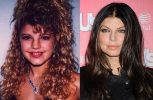Fergie rifatta prima e dopo