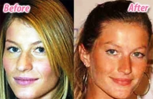 Gisele Bundchen rifatta prima e dopo