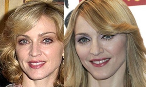 Madonna rifatta prima e dopo