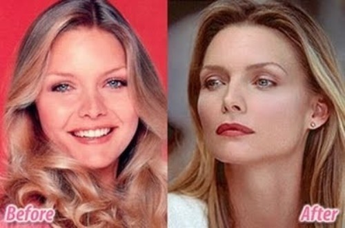 Michelle Pfeiffer rifatta prima e dopo