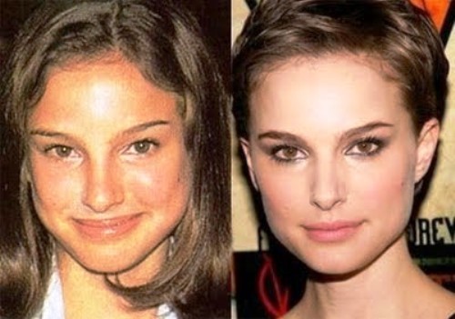 Natalie Portman rifatta prima e dopo