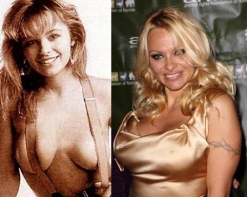 Pamela Anderson rifatta prima e dopo
