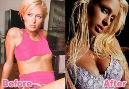 Paris Hilton rifatta prima e dopo
