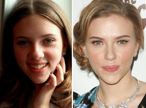 Scarlett Johansson rifatta prima e dopo