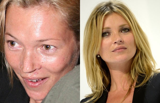 Kate Moss senza trucco