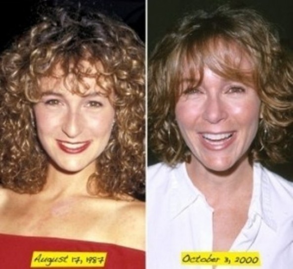 Jennifer Grey prima e dopo 