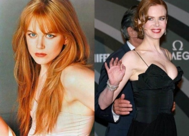 Nicole Kidman 