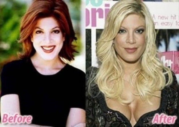 Tori Spelling
