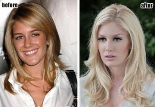 Heidi Montag