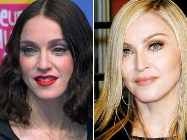 Madonna