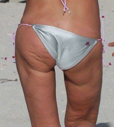 Cellulite per Tara Reid