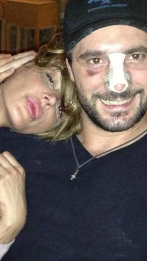 Nina Moric e Massimiliano Dossi dopo l'incidente