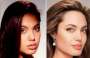 Vip rifatti: le foto delle star che sono ricorse alla chirurgia estetica